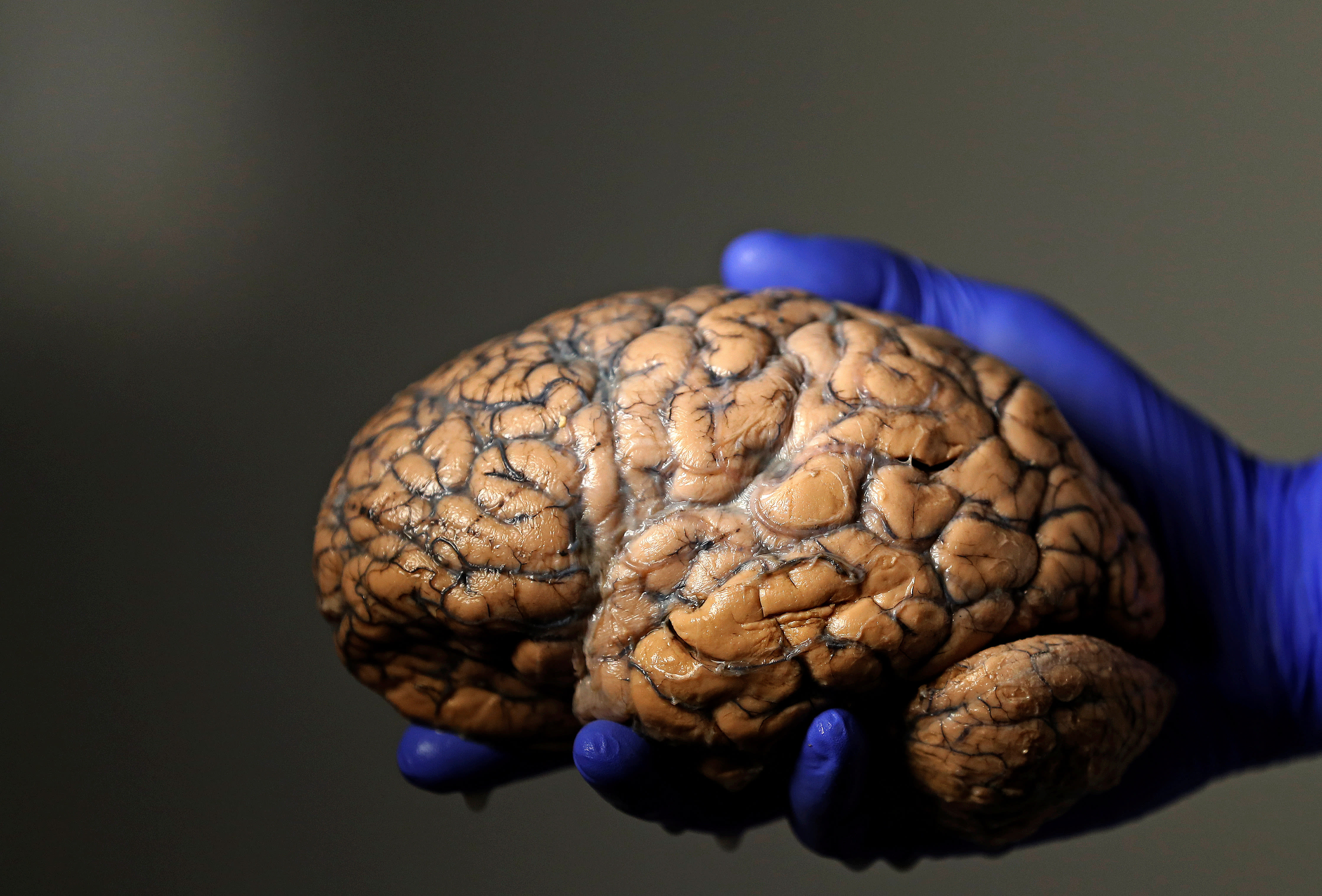 Forskere sabler ned studier om mikroplast i kroppen: – En vits