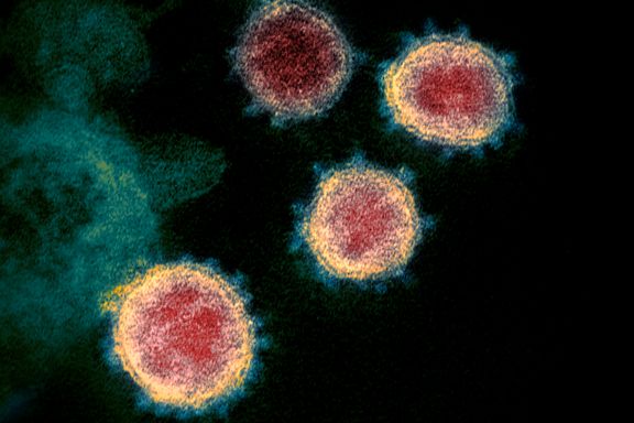 Er diskusjonen om covid-19-virusets opprinnelse avsluttet? Nei, langt ifra.