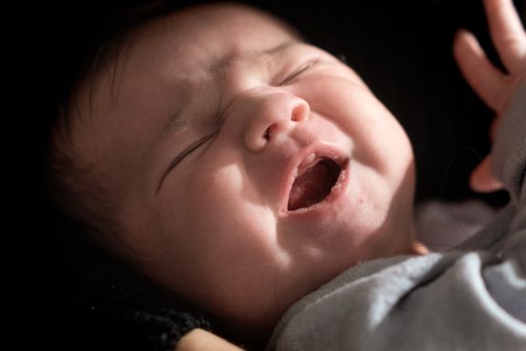 Mange norske spedbarn blir født med «for stort hode»:  – Foreldre er blitt unødvendig bekymret 