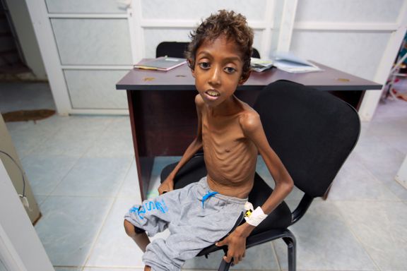 Over én million barn i Jemen risikerer å bli rammet av kolera