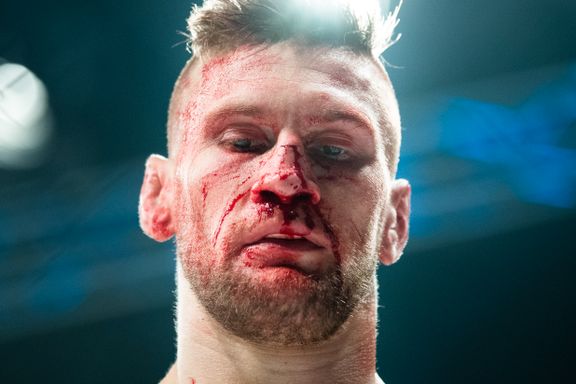 Jacobsen ut mot MMA-kaos: – Sporten er så røff i utgangspunktet, at det er dumt at slike ting skjer 