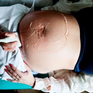 Ny studie: Større risiko ved å føde på små sykehus