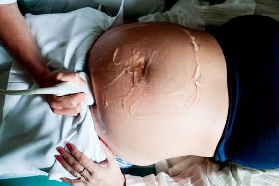 Ny studie: Større risiko ved å føde på små sykehus