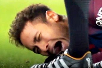  Tunge nyheter for Neymar: Røntgenbildene viser brudd i foten  