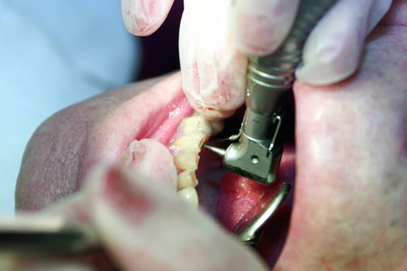 Professor ved UiO: Det hender vi får inn pasienter med totalhavari i tennene