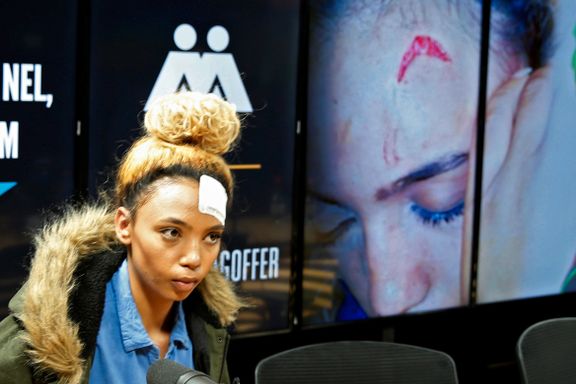 Zimbabwes førstedame angrep en 20 år gammel modell med skjøteledning