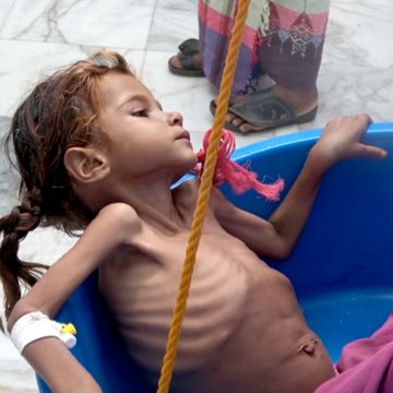 FN: Sultkatastrofen i Jemen blir verre