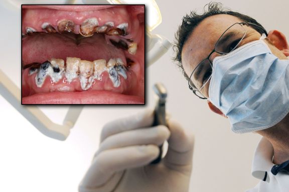 Tannlegene frykter at slike tenner ikke blir behandlet