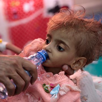  FN: Halvparten av Jemens befolkning trues av sultedød 