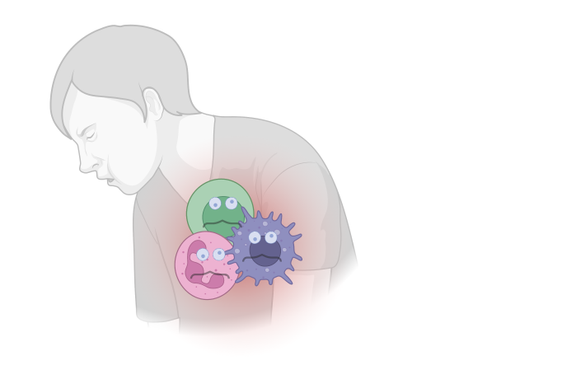 Kan endringer i immunforsvaret være årsak til senfølger etter covid-19?