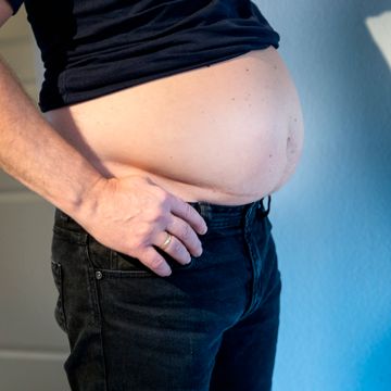 Jubler over funn i norsk forskning på fedme: – Utrolig gledelig