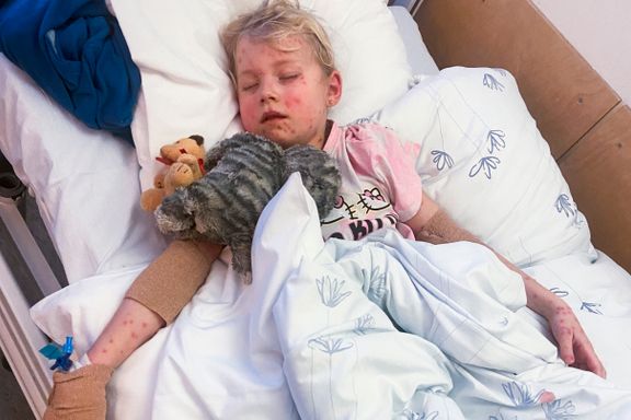 Klara (6) måtte på sykehus med vannkopper. Flere barn blir alvorlig syke.