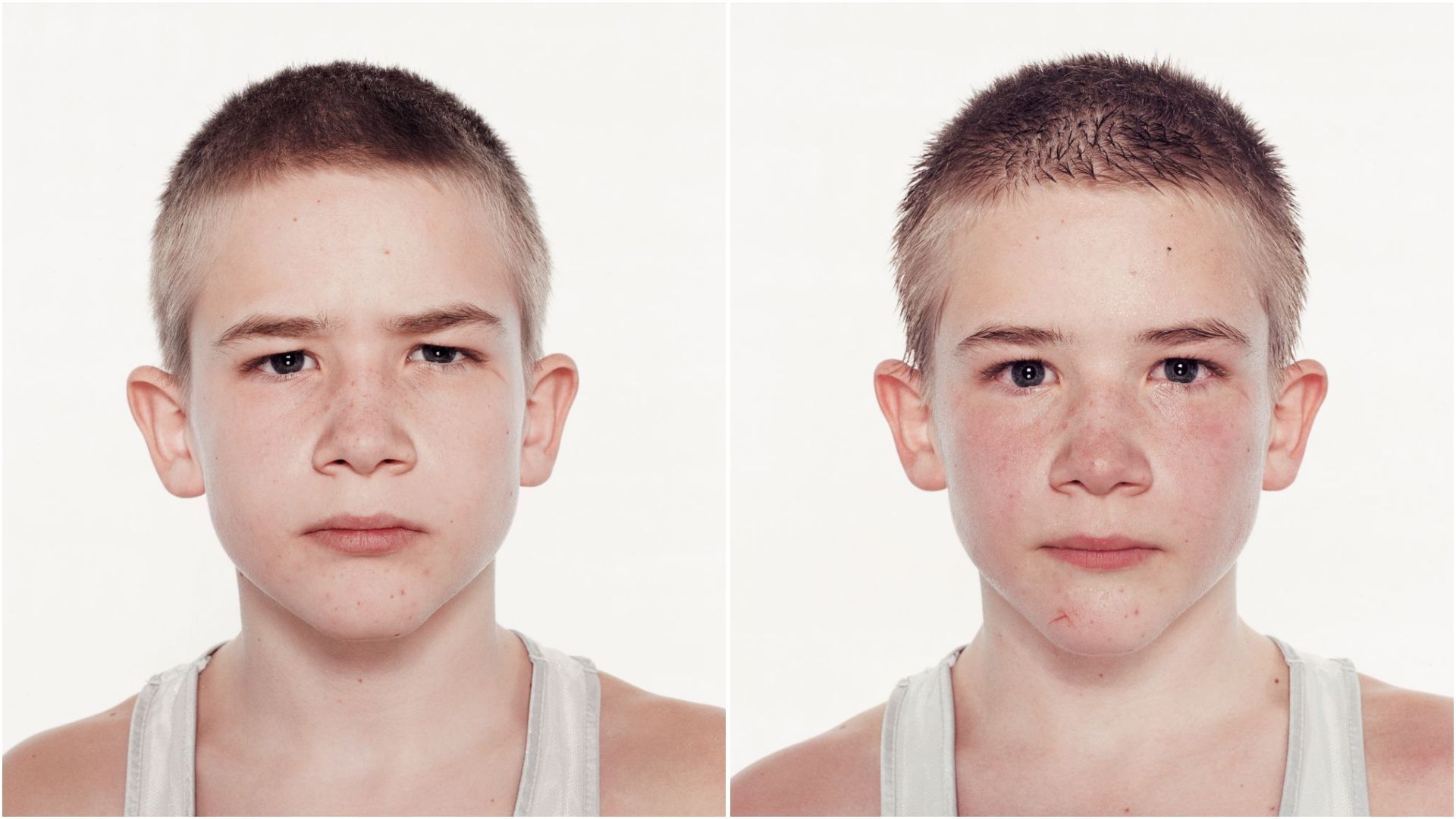 Изменение мужчины по возрасту. Изменения во внешности подростка. Лицо подростка. Внешность подростка.
