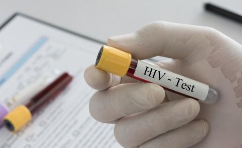 HIV/AIDS epidemien kan gå mot slutten. Aldri før har det vært så lovende resultater fra en vaksine som i 2016.