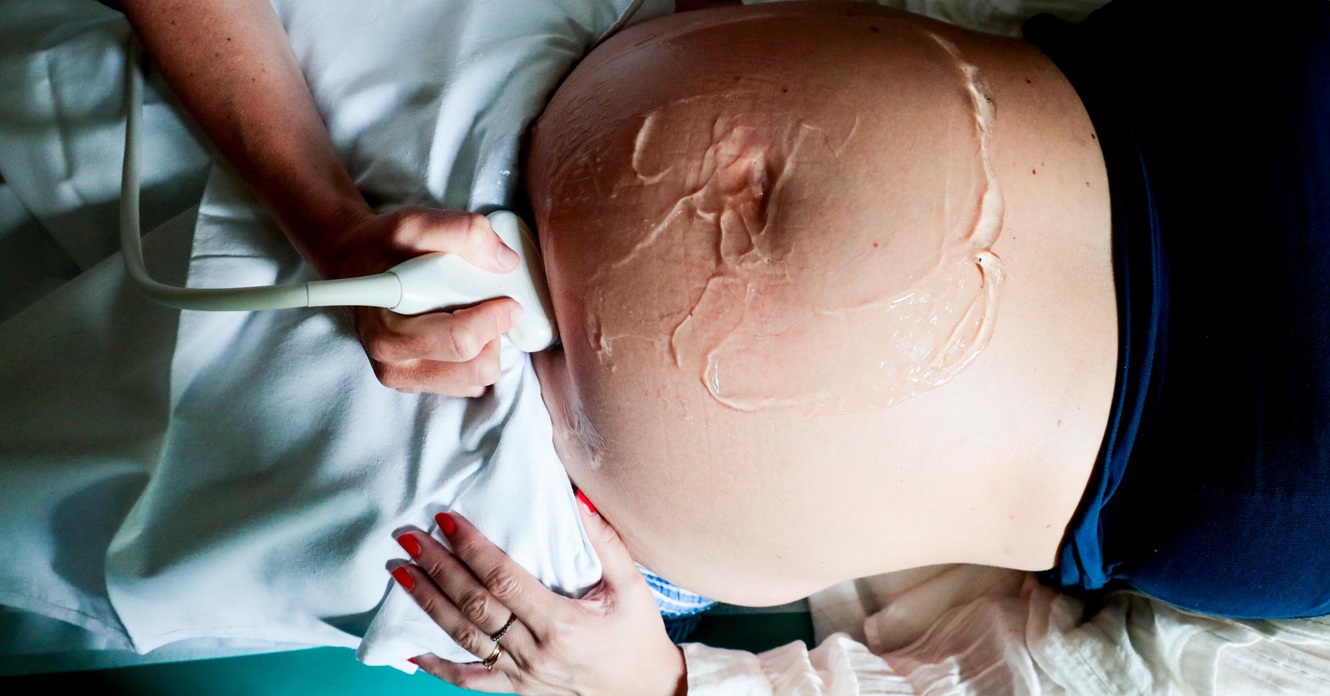 10 SUS-jordmødre jobber privat: – Det koster om lag 1 million å utdanne ei ultralydjordmor