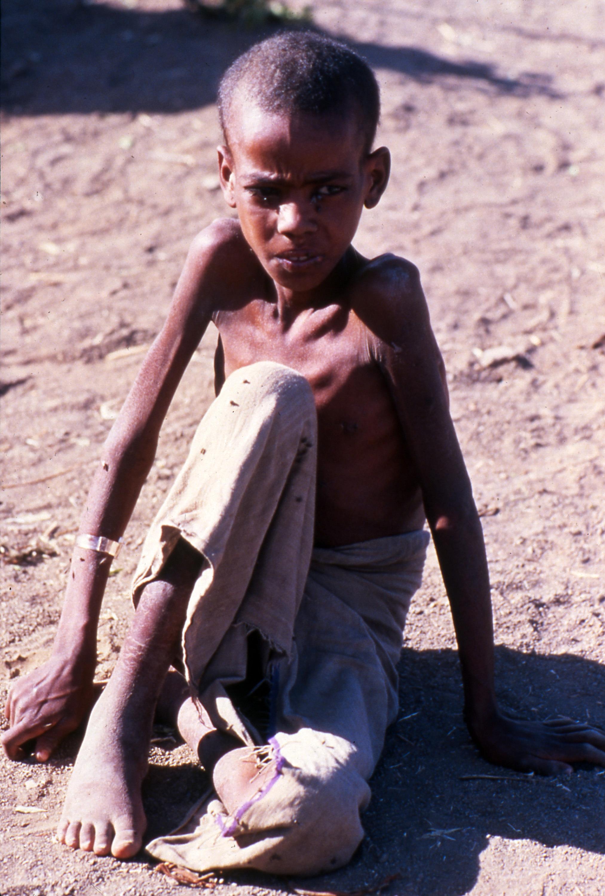 November 1984. En ung gutt fotografert i en flyktningleir i Bati, sørvest i Etiopia. Amerikanske og sovjetiske luftfartøyer fraktet mat til de mange tusen menneskene som befant seg der. d
