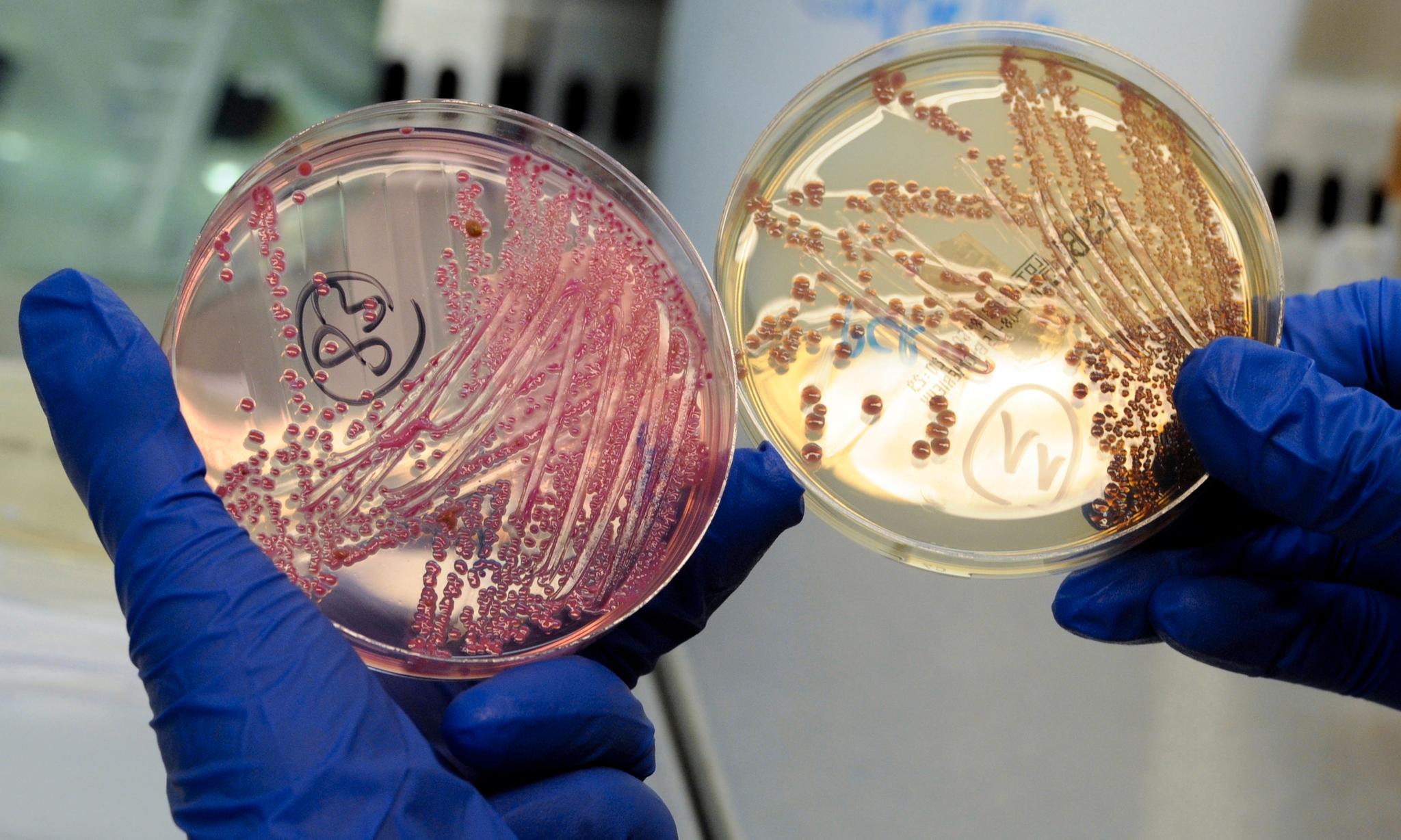 En variant av E-coli kan føre til alvorlig sykdom hos barn og eldre.