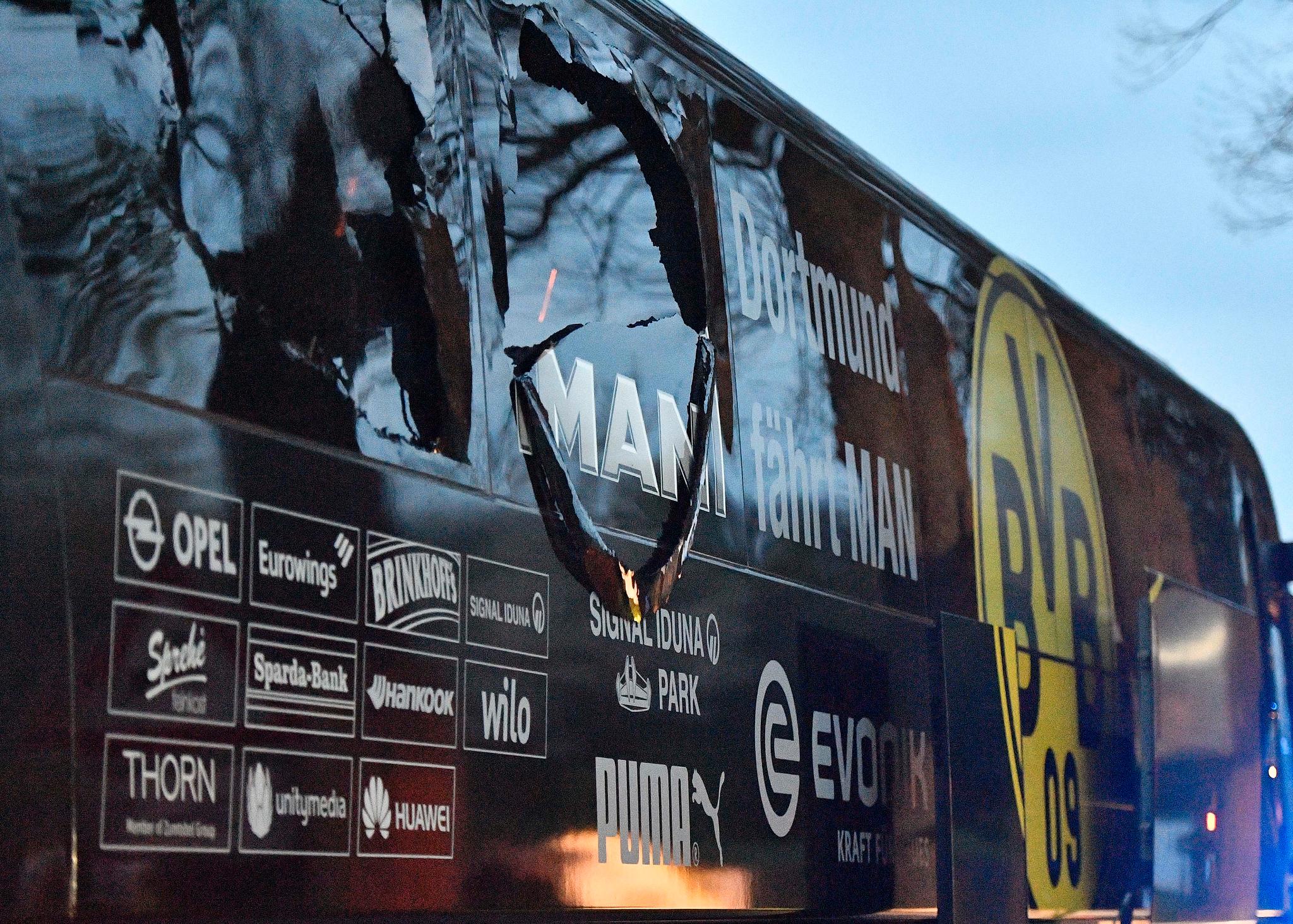 Slik så bussen til Borussia Dortmund ut etter eksplosjonen.