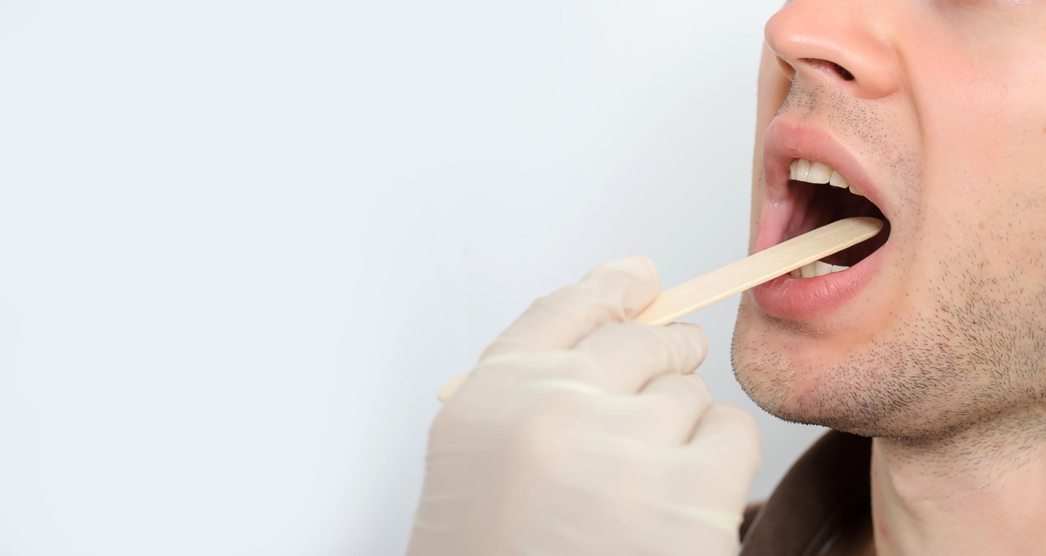 En sunn munn er viktig for en sunn kropp. Men tas munntørrhet alvorlig nok? spør innleggsforfatteren.