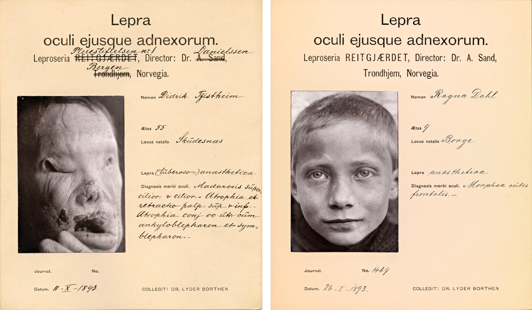 Samme sted. Spedalske barn levde ofte sammen med eldre mennesker på institusjonene - og så hvordan de kanskje kom til å bli. Den ni år gamle Ragna (til høyre) bodde i 1893 på Reitgjerdet sammen med den 55 år gamle Didrik.