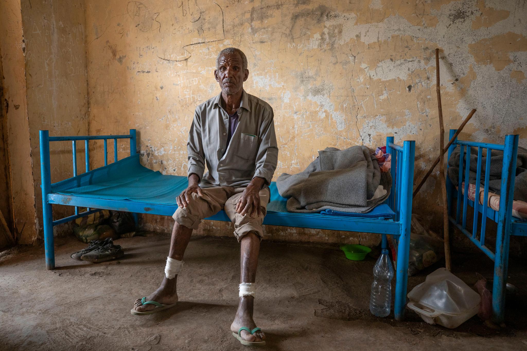 54 år gamle Guesh Tedla fra Tigray-regionen viser skadene han fikk etter å ha blitt slått med stokker. Bildet er tatt i Hamdeyat-senteret i Øst-Sudan 15. desember.