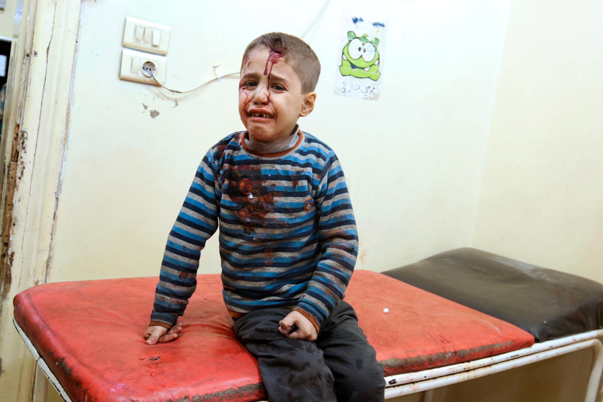 En skadet gutt venter på behandling etter et luftangrep i Aleppo. Nå er er alle sykehus i den opprørskontrollerte delen av byen satt ut av drift.