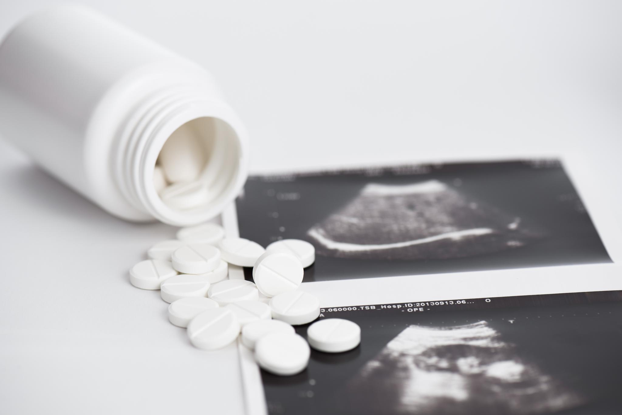 Nærmere 90 prosent av aborter i Norge i dag utføres medikamentelt. 
