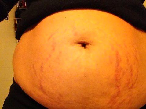 Gry Larsen og ektemannen fikk sitt andre barn for to måneder siden. Larsen delte bilde av magen sin i sosiale medier.