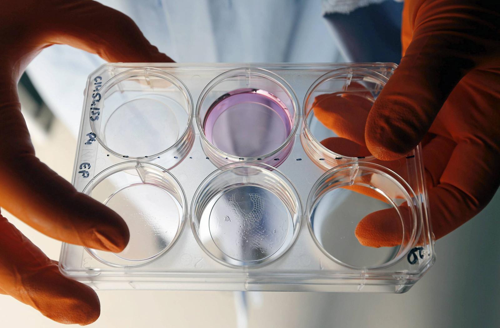 Franske forskere har utviklet en ny teknologi for såkalt bioprinting, som gjør det mulig å printe levende vev til bruk i blant annet kosmetikk, farmakologi og kirurgi - spesielt hudtransplantasjoner.