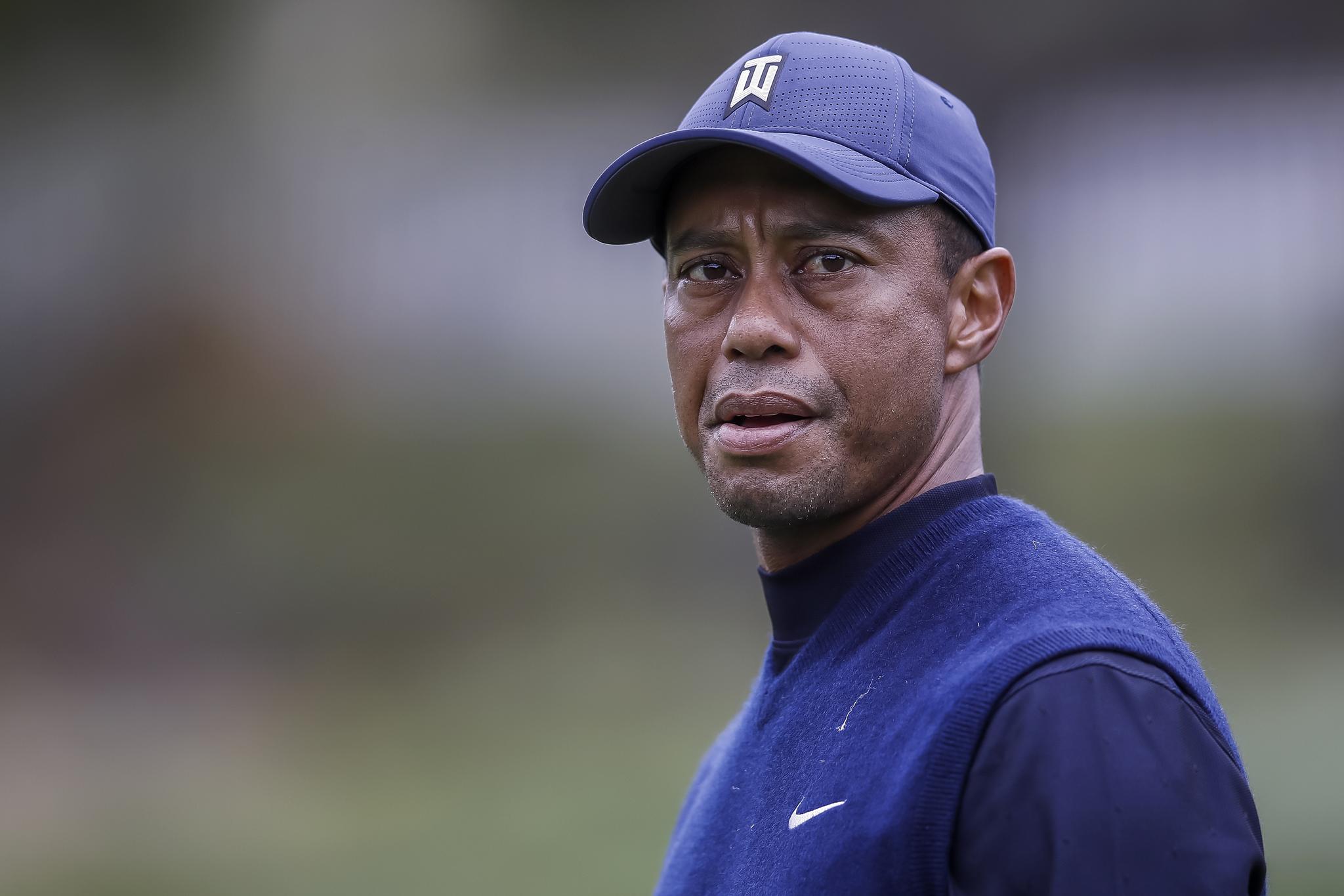 SKADET: Tiger Woods måtte opereres etter en alvorlig bilulykke i California tirsdag.