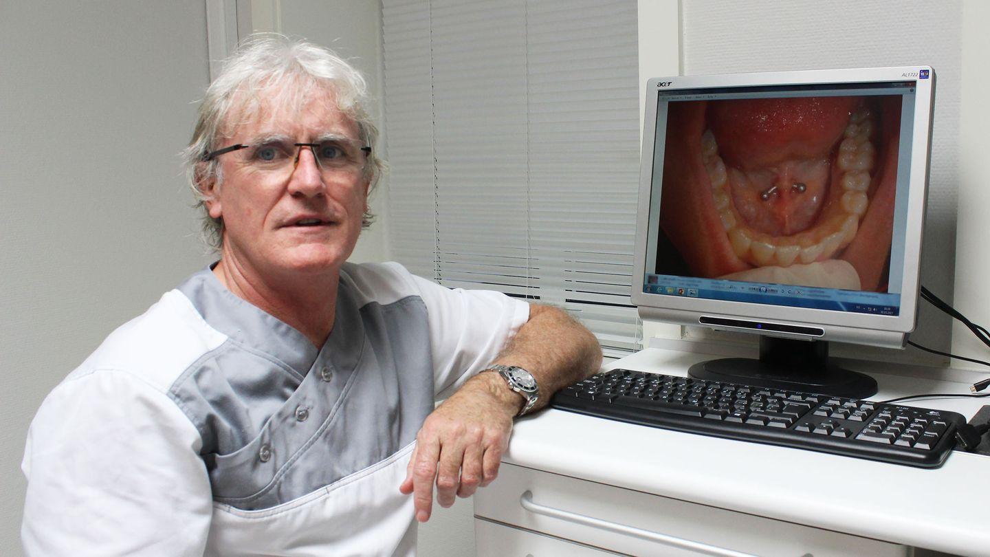 Tannlege Mark Lowey var ikke imponert da han fant denne piercingen under tunga til ei 15 år gammel jente. 