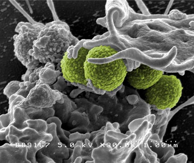 Bakterier.jpg